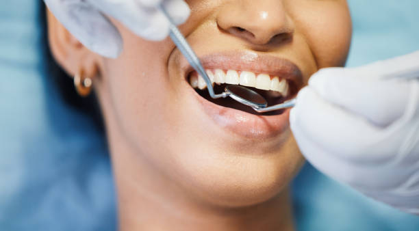 Best Urgent Care for Lost Fillings or Crowns in Kekoskee, WI