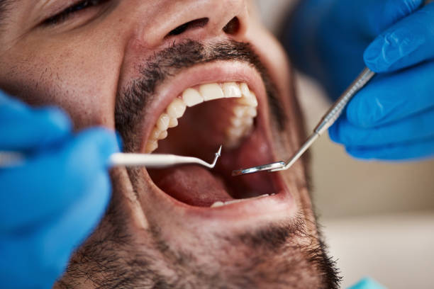 Best Emergency Gum Treatment in Kekoskee, WI